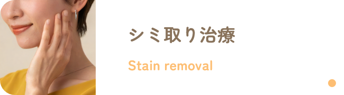 シミ取り治療