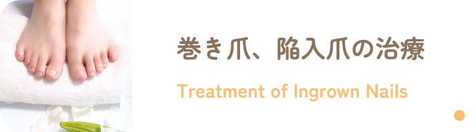 巻き爪、陥入爪の治療