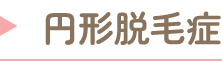 円形脱毛症